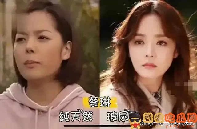 有种毁容叫依赖玻尿酸,萧蔷张檬我忍了,看到娄艺潇打死也忍不了-吃瓜网
