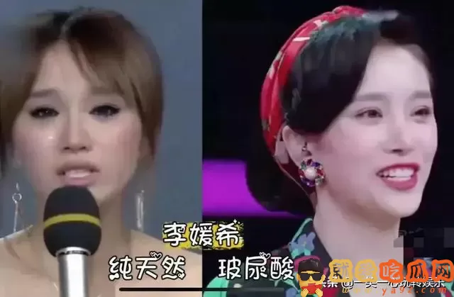 有种毁容叫依赖玻尿酸,萧蔷张檬我忍了,看到娄艺潇打死也忍不了-吃瓜网