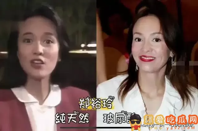 有种毁容叫依赖玻尿酸,萧蔷张檬我忍了,看到娄艺潇打死也忍不了-吃瓜网