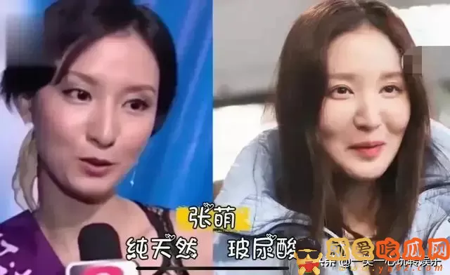 有种毁容叫依赖玻尿酸,萧蔷张檬我忍了,看到娄艺潇打死也忍不了-吃瓜网